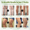 Vein Relief Cream