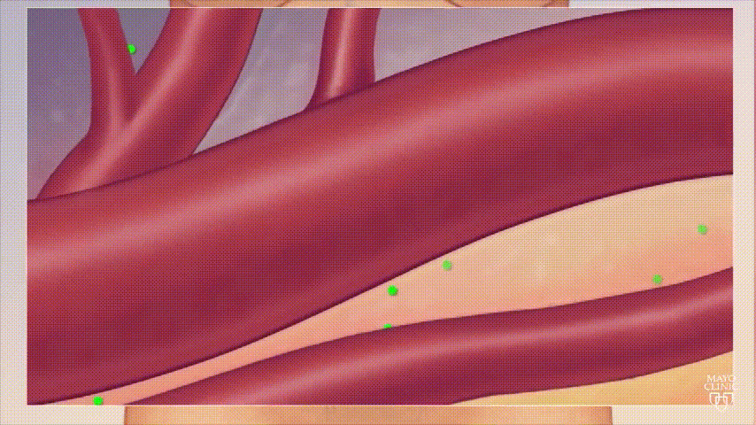 1713199529805656.gif Po leczeniu.gif