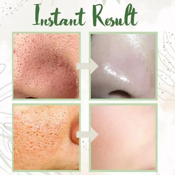 Green Tea Deep Cleanse Mask [Last Day!] Free Shipping