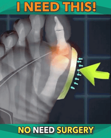 ComfyFootgear&trade; Bunion Corrector Sandals with Back Strap