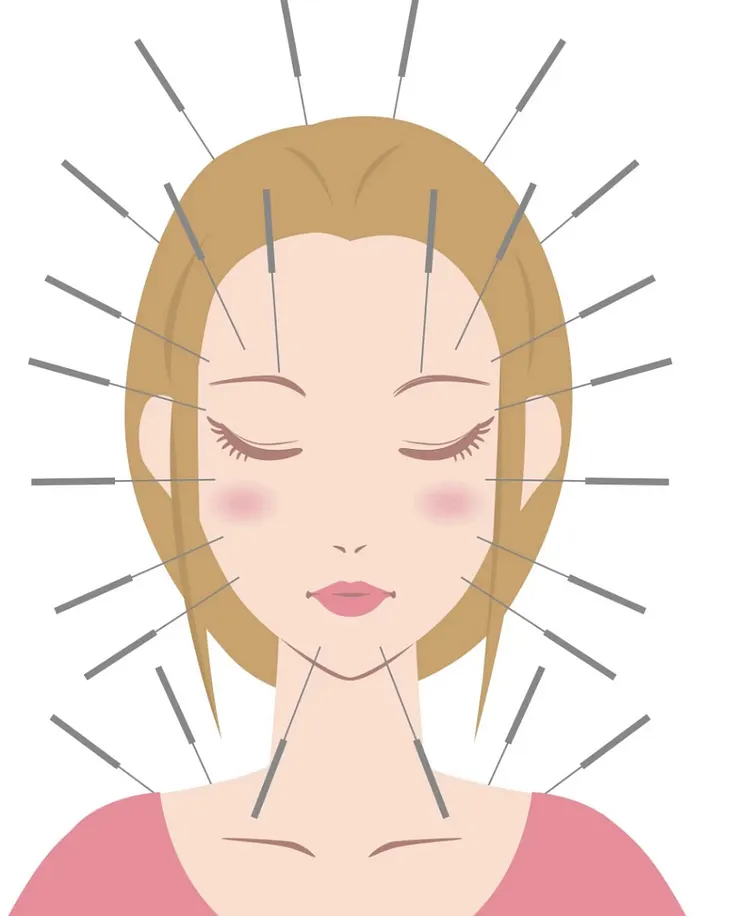 Non-Invasive Acupuncture Treatment-- For Sensitive Area EYE/ FACE/HEAD and Child/ Pets Pain Issue