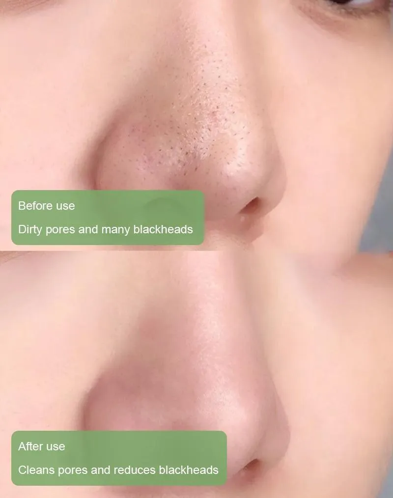 Final Sale - Green Tea Deep Cleanse Mask - Free Shipping [Last Day!]