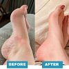 🎉 FATHER'S DAY SALE OFF 60%🔥 Foot Massager - For Lasting Foot Pain Relief-Fotg