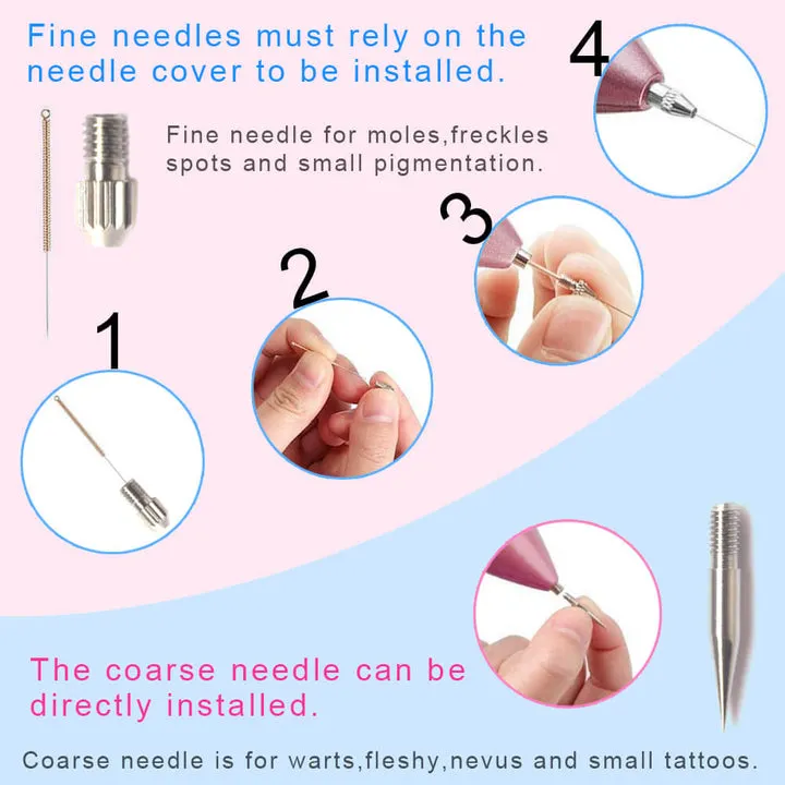 Laser Plasma Mole Remover Pen