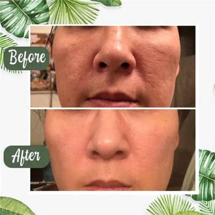 🔥Buy 1 Get 1 Free(2 Pcs) | 🔥 Poreless Deep Cleanse Green Tea Mask