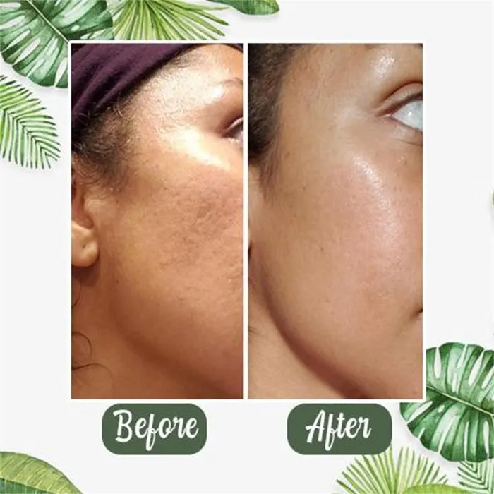 🔥Buy 1 Get 1 Free(2 Pcs) | 🔥 Poreless Deep Cleanse Green Tea Mask