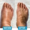🎉 FATHER'S DAY SALE OFF 60%🔥 Foot Massager - For Lasting Foot Pain Relief-Fotg