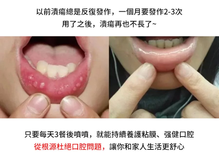 牙痛寧