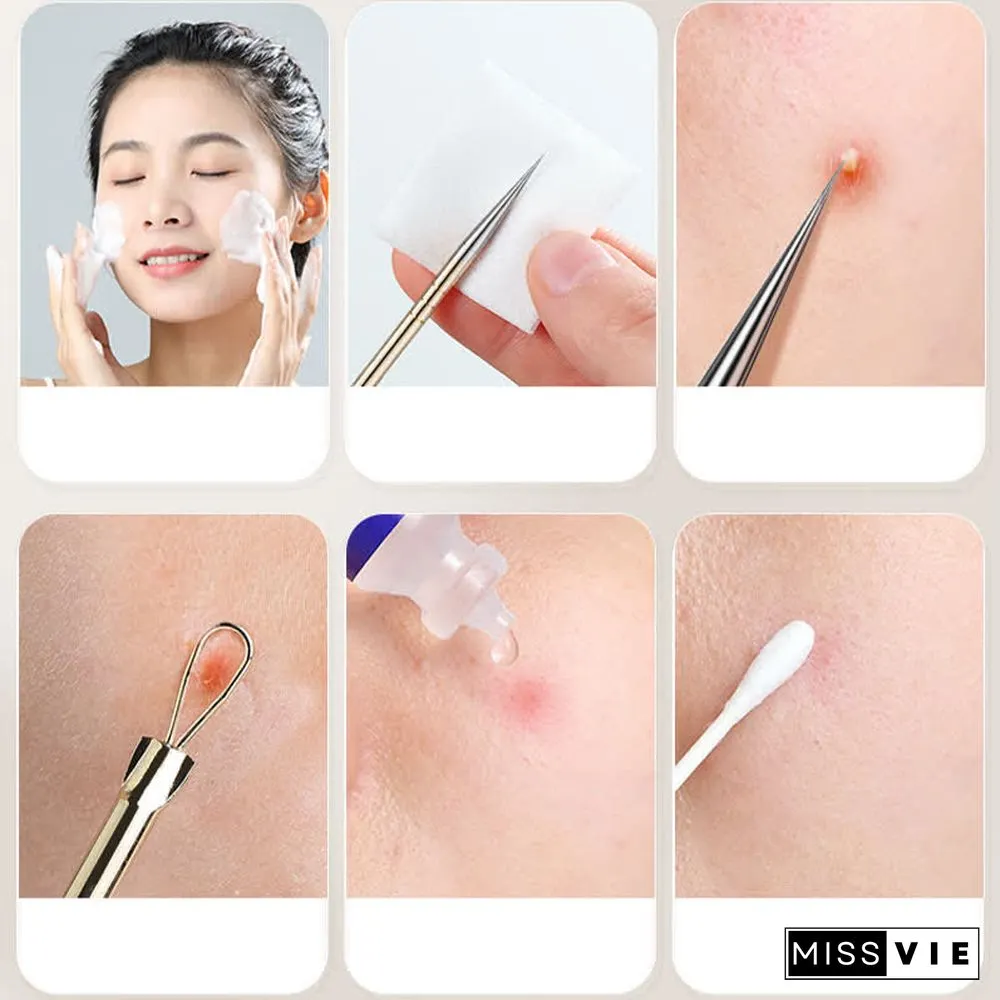 Kind Bobee Stainless Steel Double Ended Acne Needle