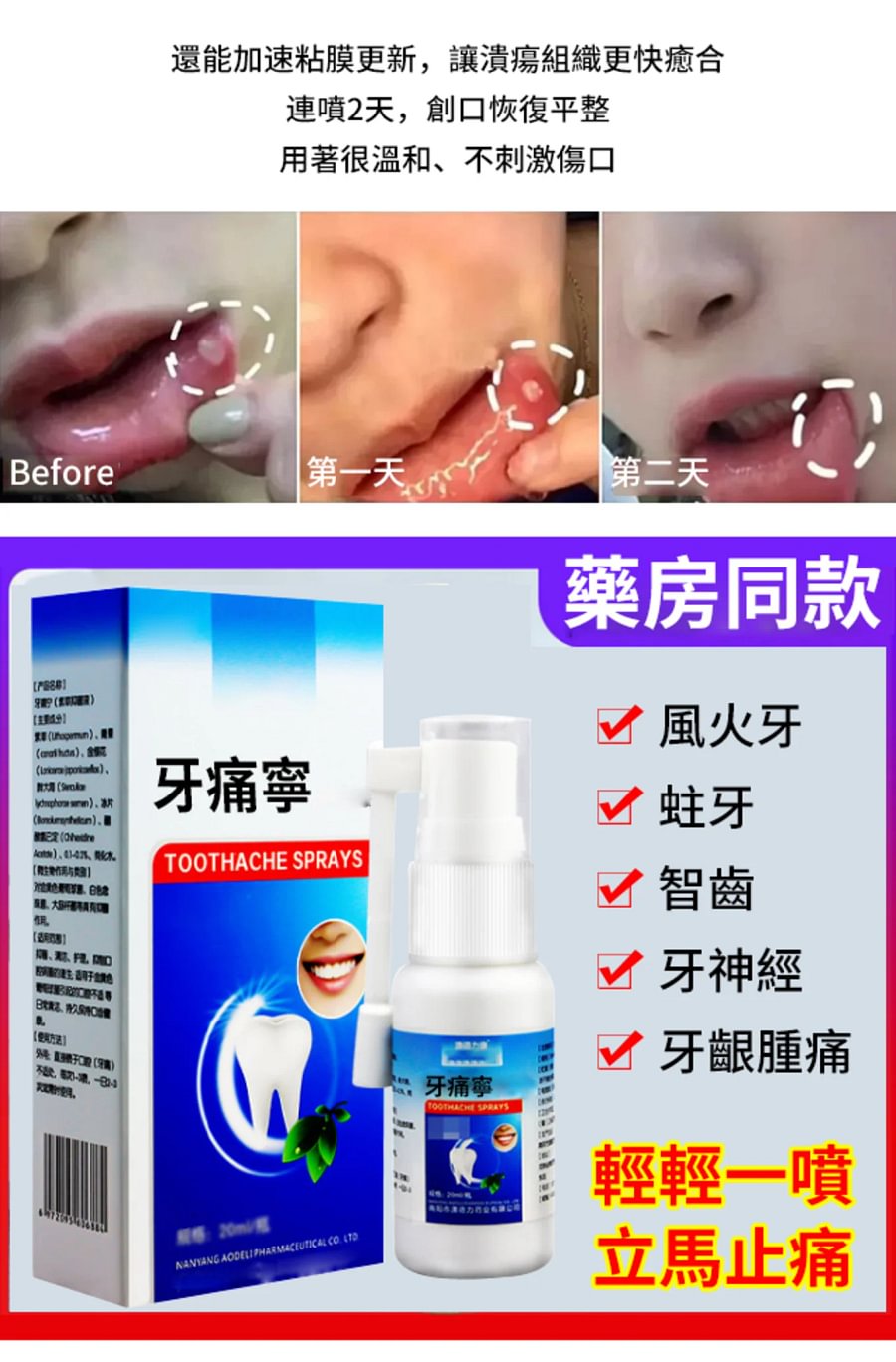 牙痛寧