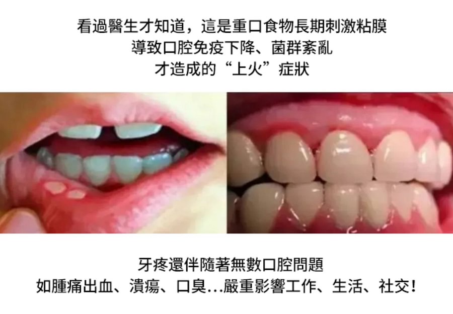 牙痛寧