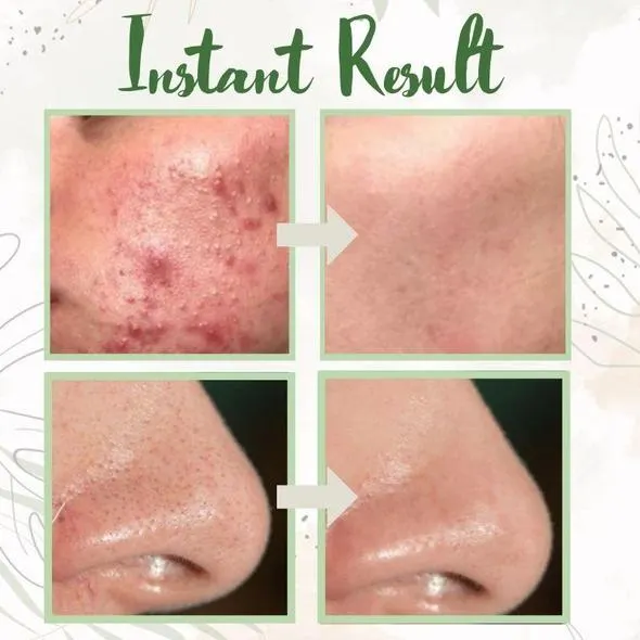 Green Tea Deep Cleanse Mask [Last Day!] Free Shipping