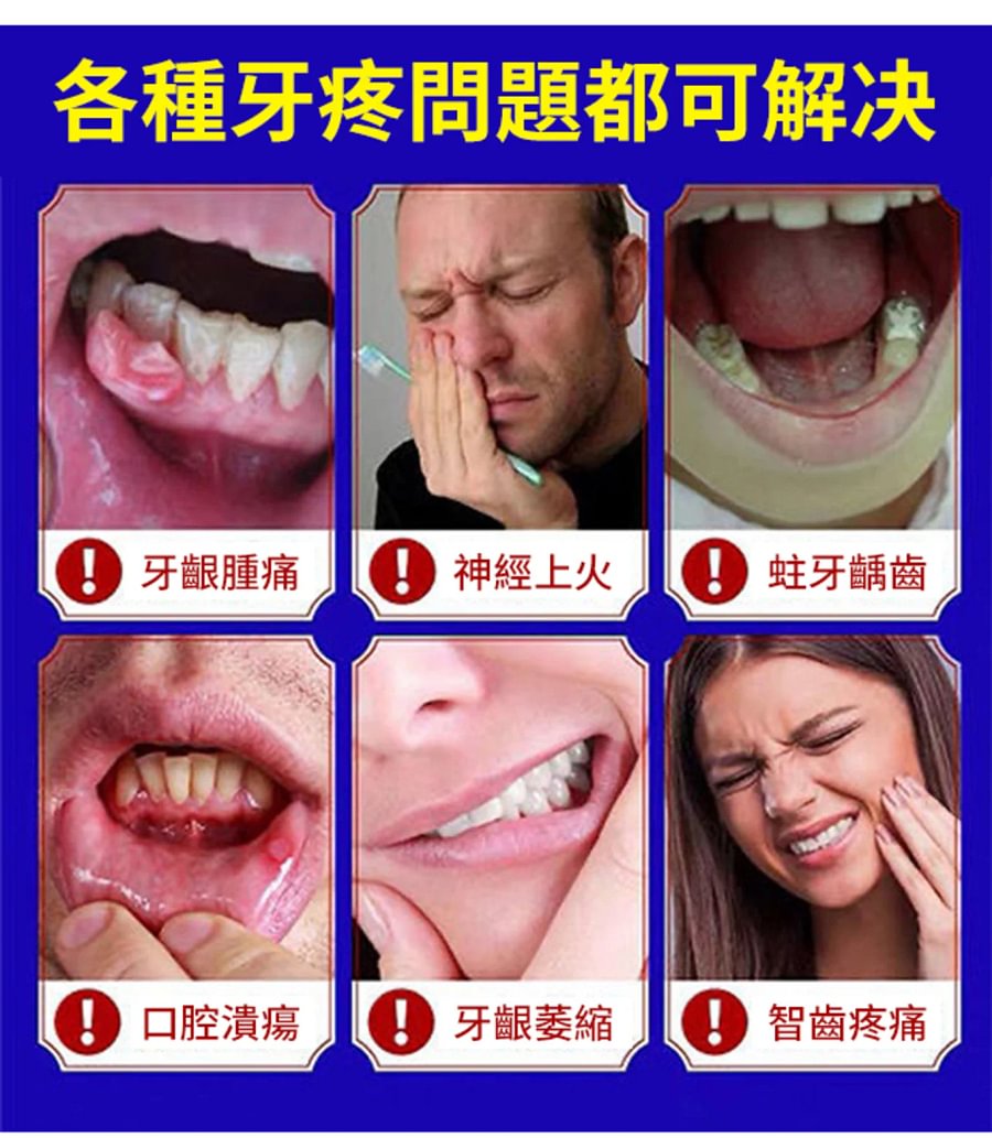 牙痛寧