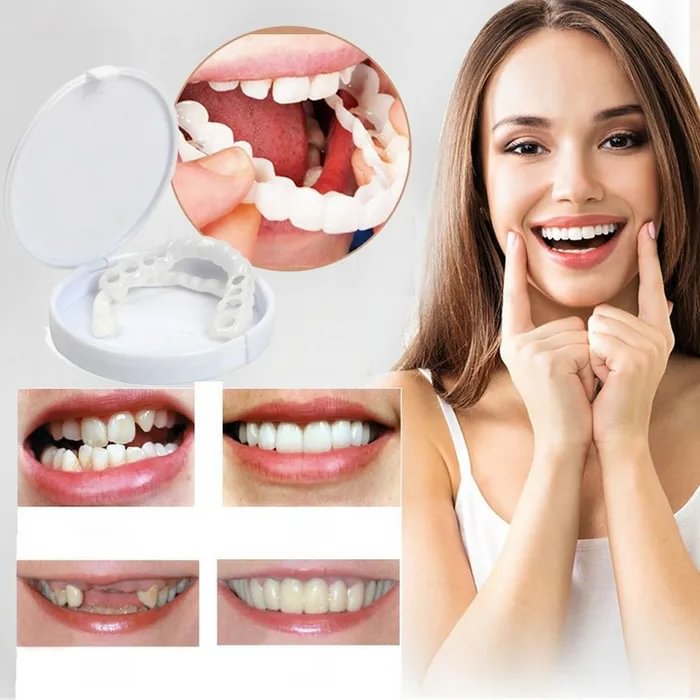 🔥 50% OFF🔥Latest Adjustable Snap On Dentures
